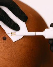 Skin Tag & Mole Removal