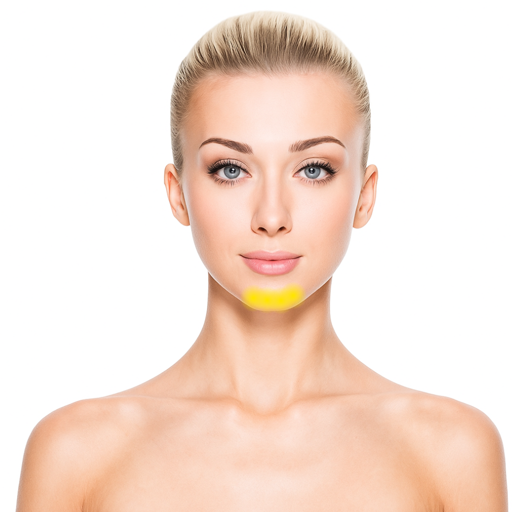 Chin Laser Hair Removal