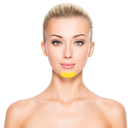 Chin Laser Hair Removal