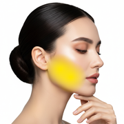 Sideburns Laser Hair Removal