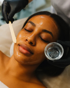 Chemical Peel